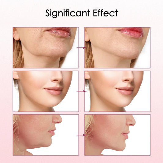 Facelift 2.0: The Home Care Revolution