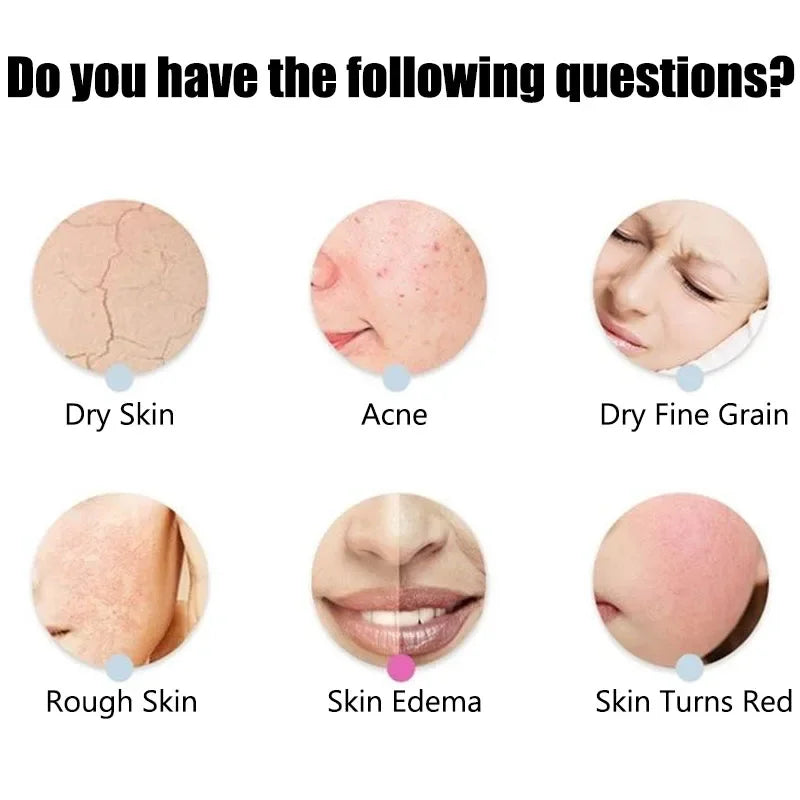 Boule de massage en Silicone pour Lifting de la peau du visage